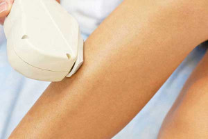 Intense Pulsed Light (IPL) - Lower Legs [4 Sessions]